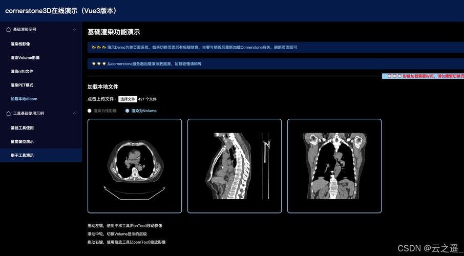 DICOM攻略
