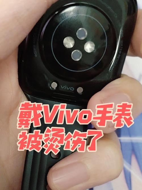 vivo手表被无限版