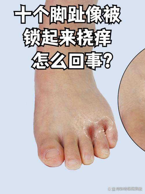 把十个脚趾头固定住挠痒痒