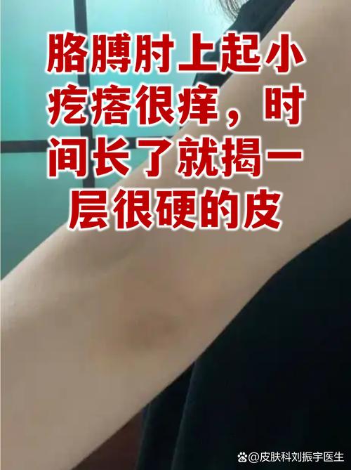 皮了多下拉