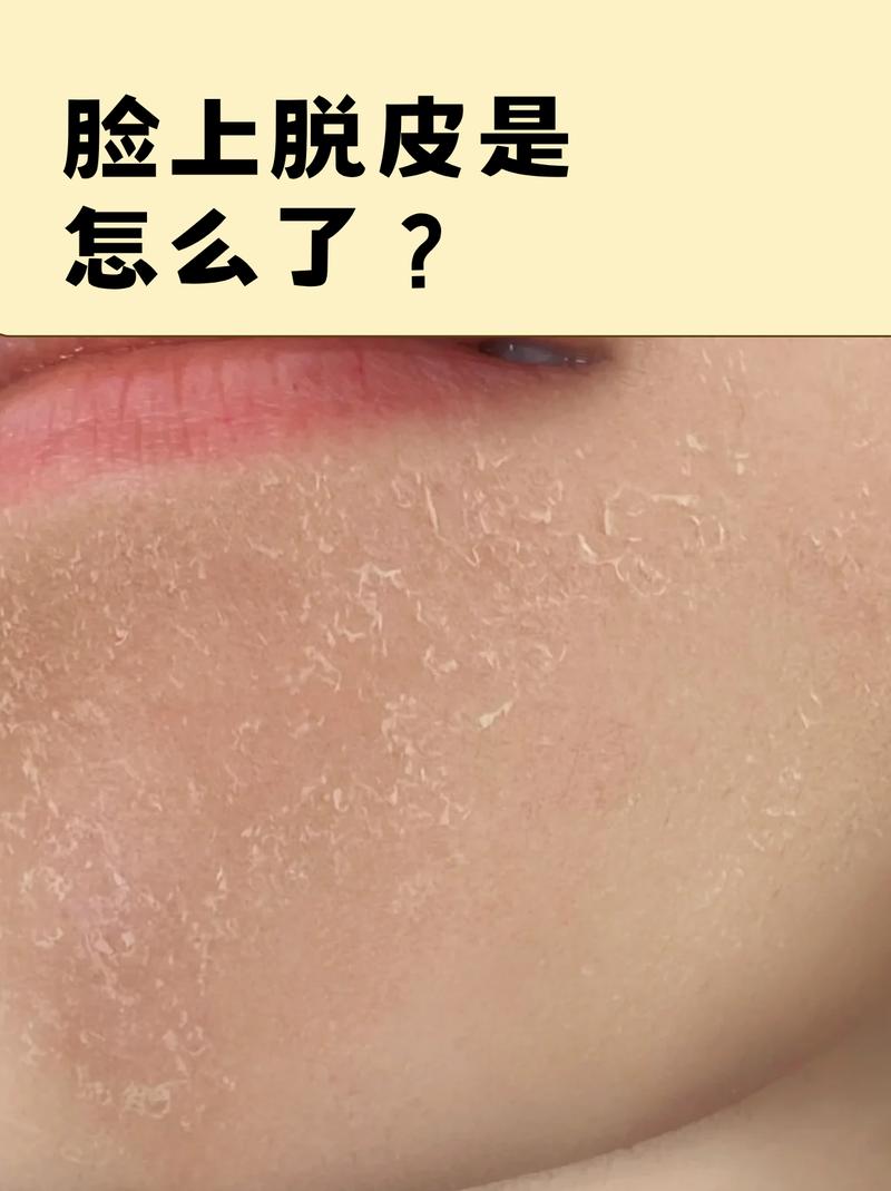 皮多了