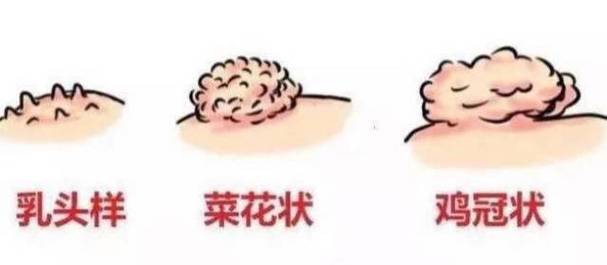 男生私密部位露出来无病毒