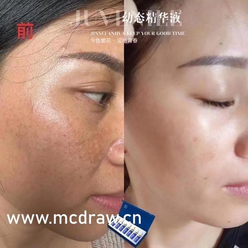 蘑菇mogu132apk版本