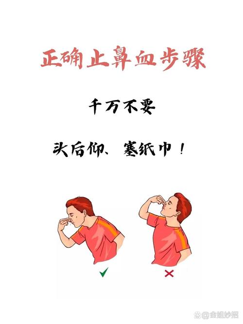 acfan流鼻血使用方法
