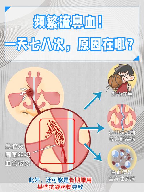 afcan流鼻血黄化的更新内容版高清画质