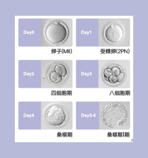 小熊移植的ti内购最新版