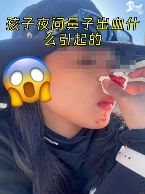 18cmic流鼻血版本