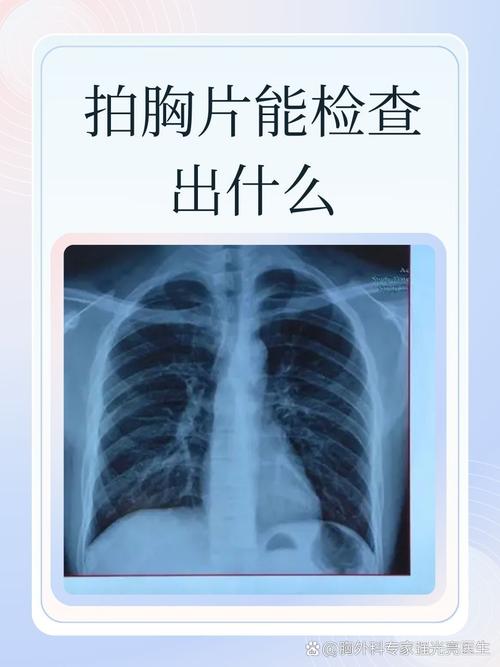 100胸片曝光率免费无病毒