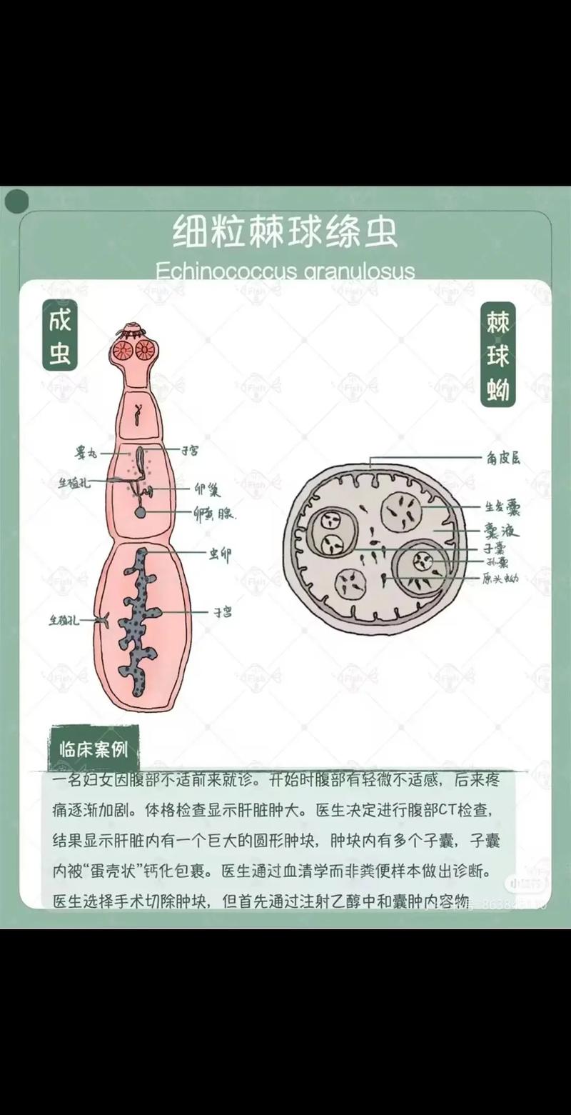 寄生虫第三阶段